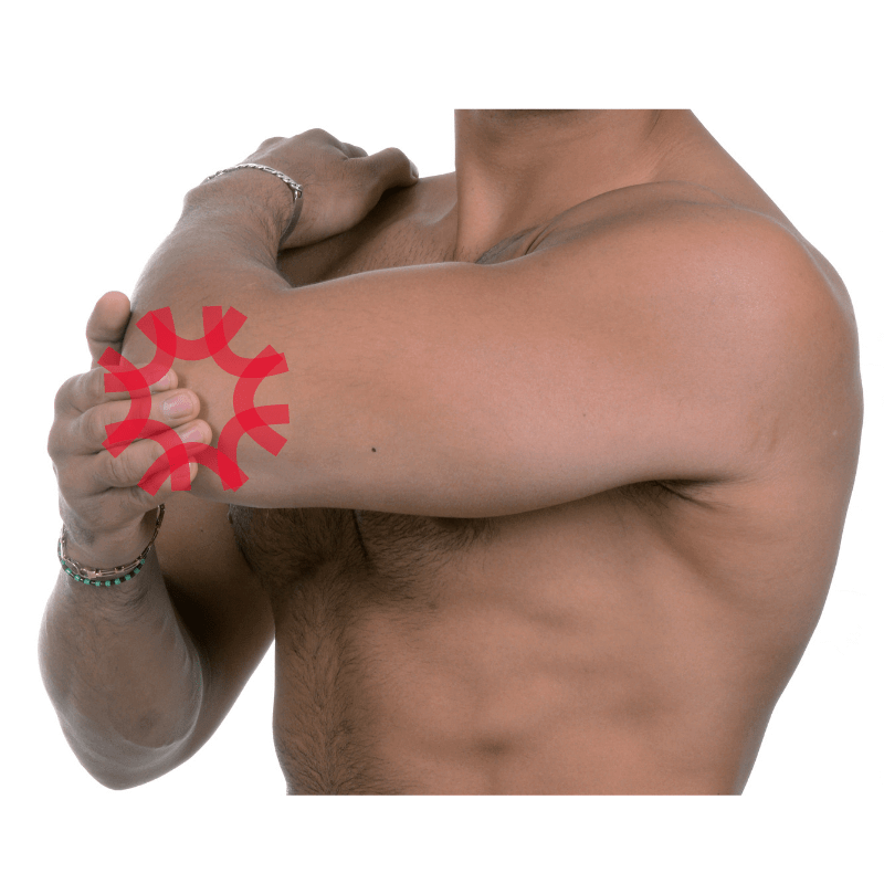 Elbow pain physio parramatta